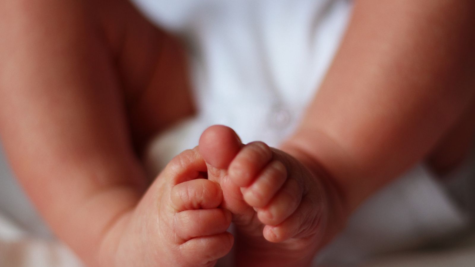 Exploring the Impact of Treatment in Late-Diagnosed Clubfoot
