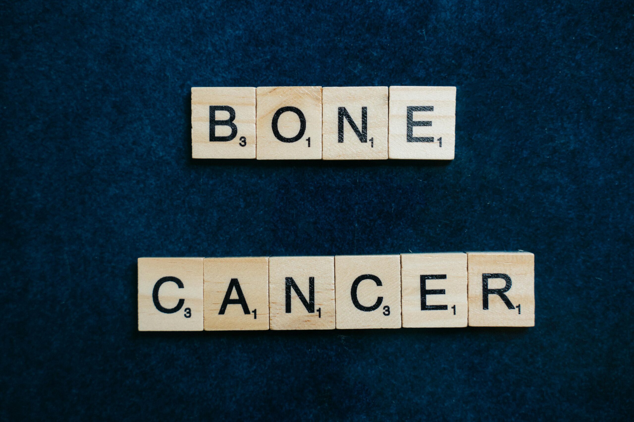 Common Bone Cancer Myths and the Real Facts Behind Them
