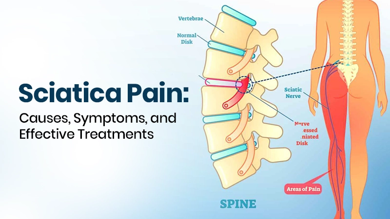 Sciatica Treatment in Hisar: Relief from Leg Pain at Orthomed Hospital