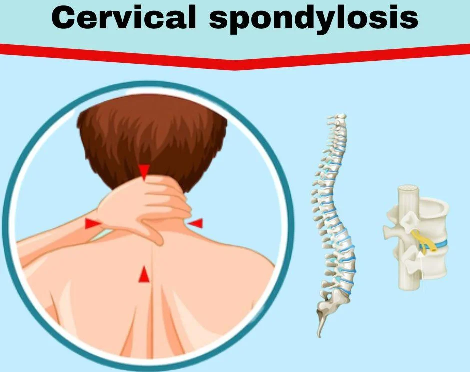Hisar’s Leading Spondylosis Treatment – Expert Solutions for Spine Arthritis
